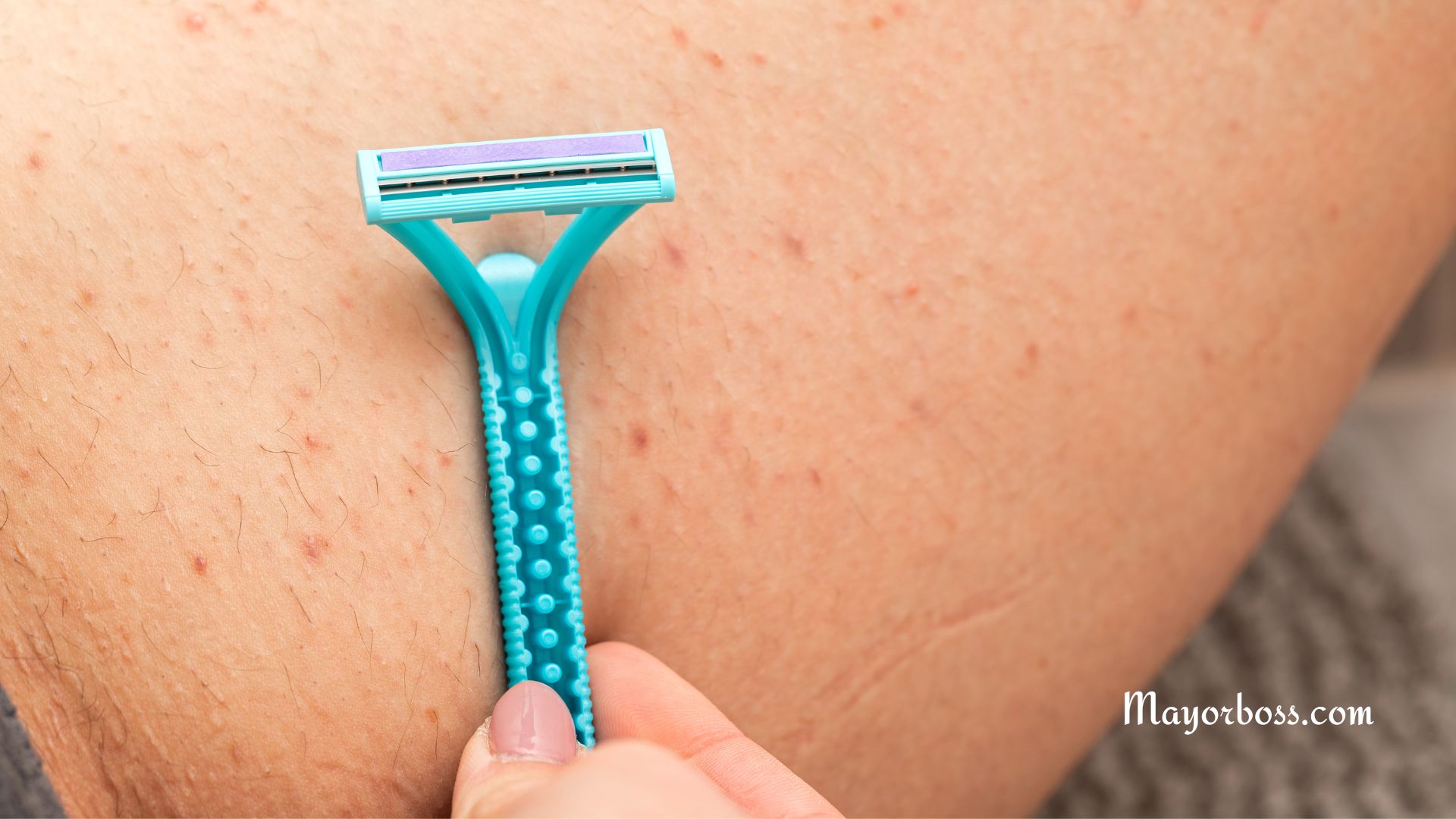 How to Get Rid of Razor Bumps