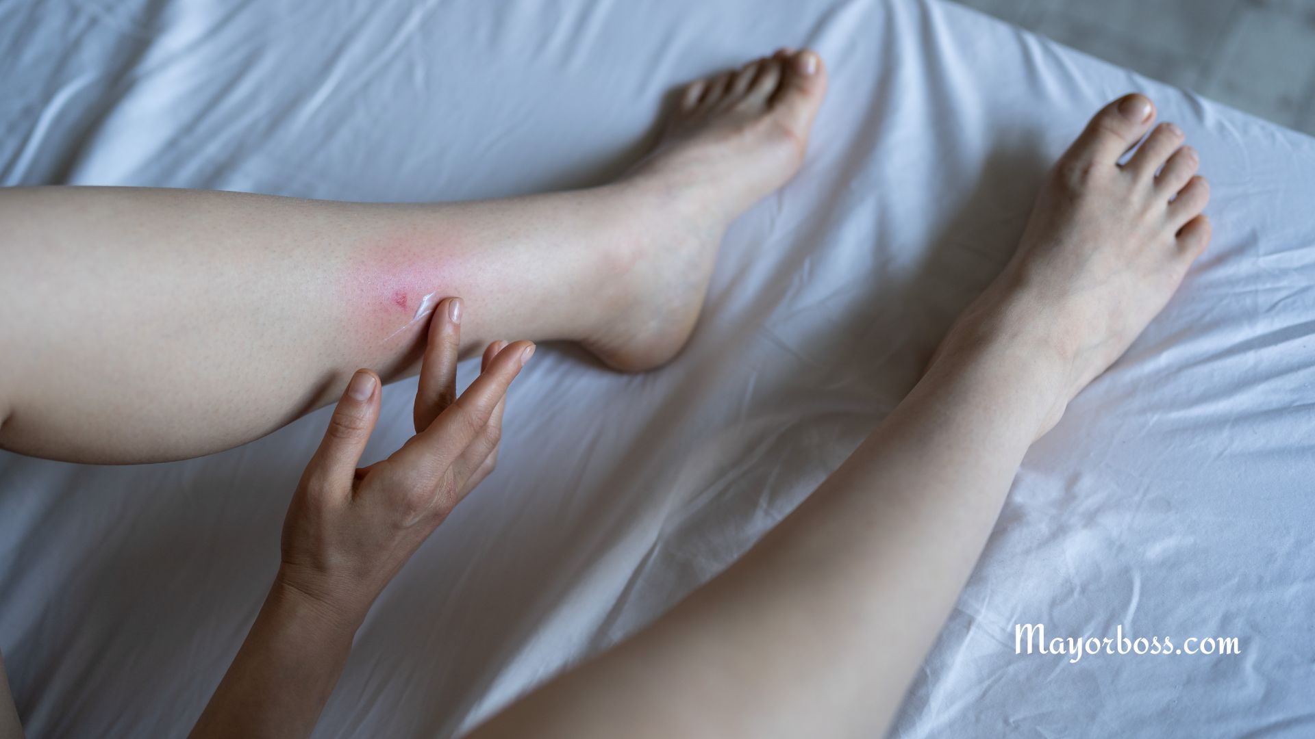 What Insects Are Biting You As You Sleep?