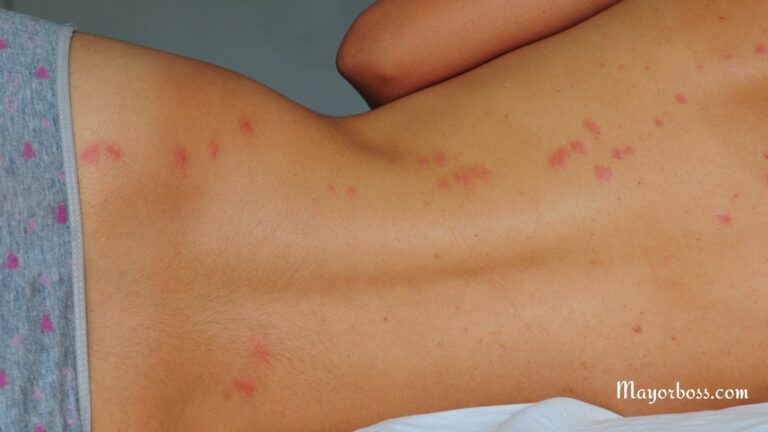 How to Know if You Have Bed Bugs (1)