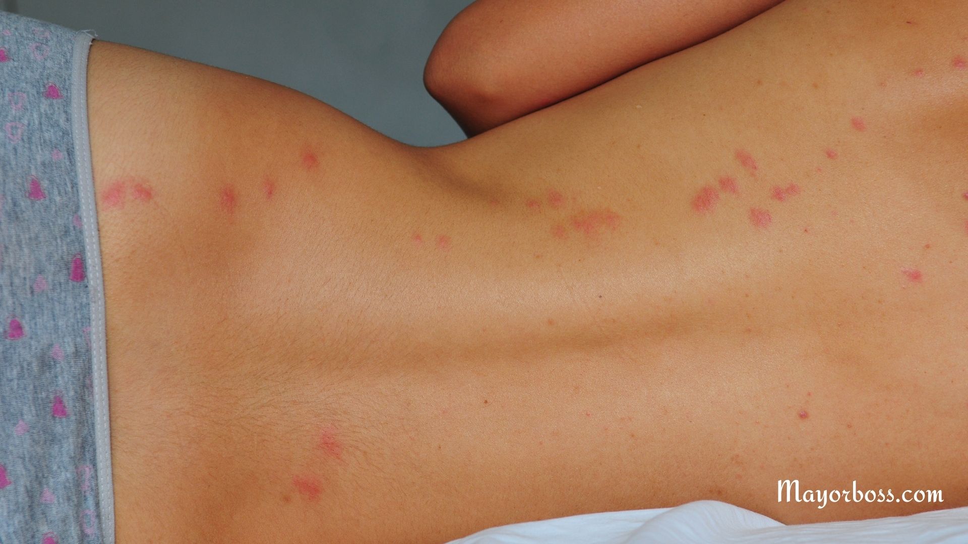 How to Know if You Have Bed Bugs (1)