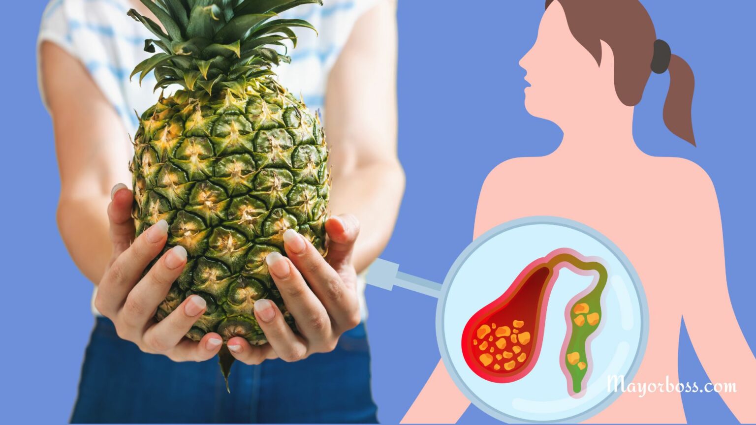 What To Eat When You Have Gallstones