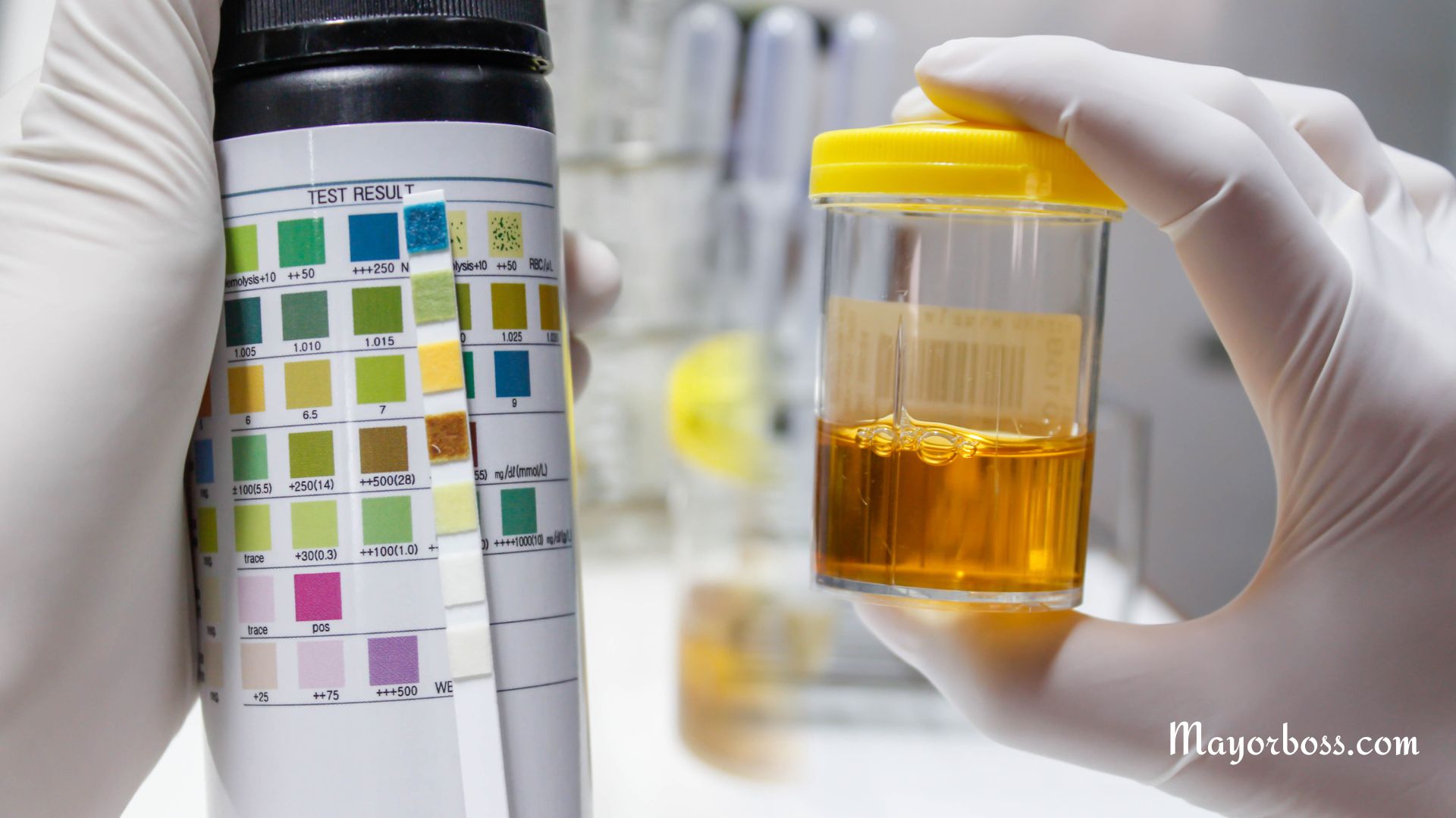 What Does Cloudy Urine Mean