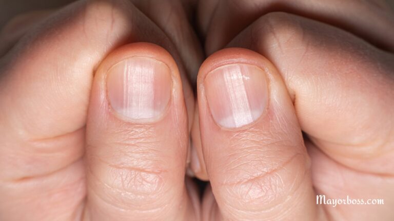 What It Means When You Have Half Moons on Your Nails