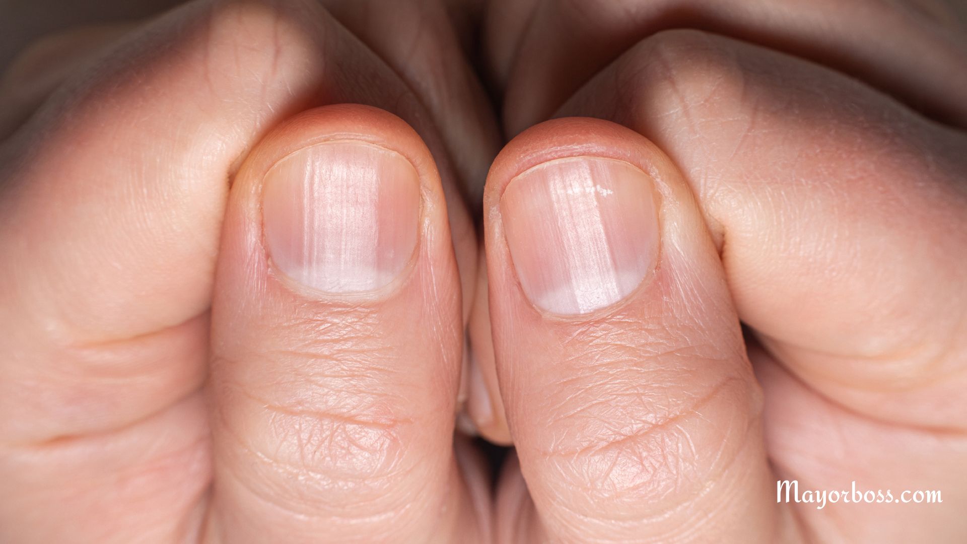 What It Means When You Have Half Moons on Your Nails