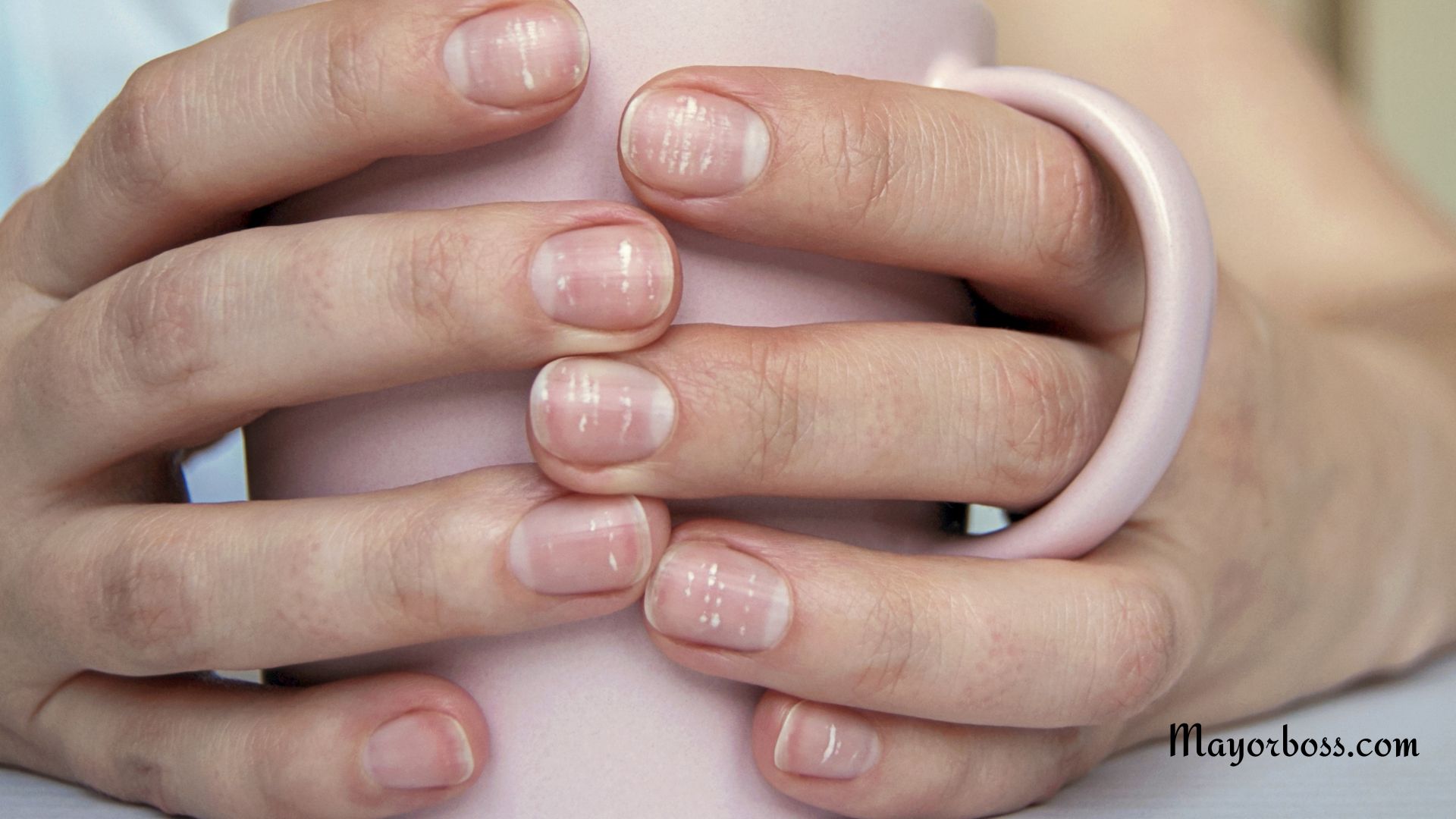 What It Means When You Have White Spots On Your Nails