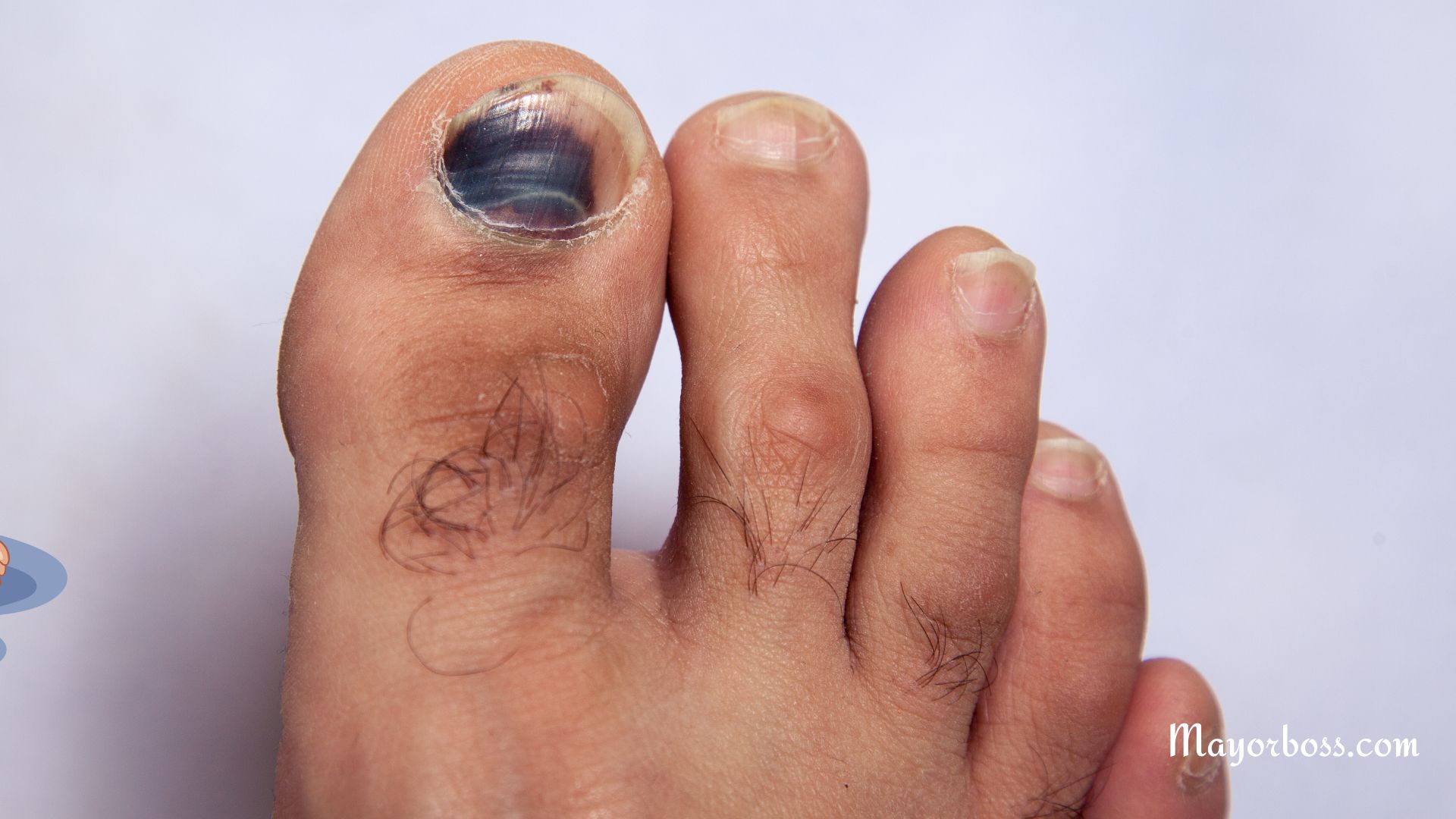 What Your Toenail Color Says About Your Health