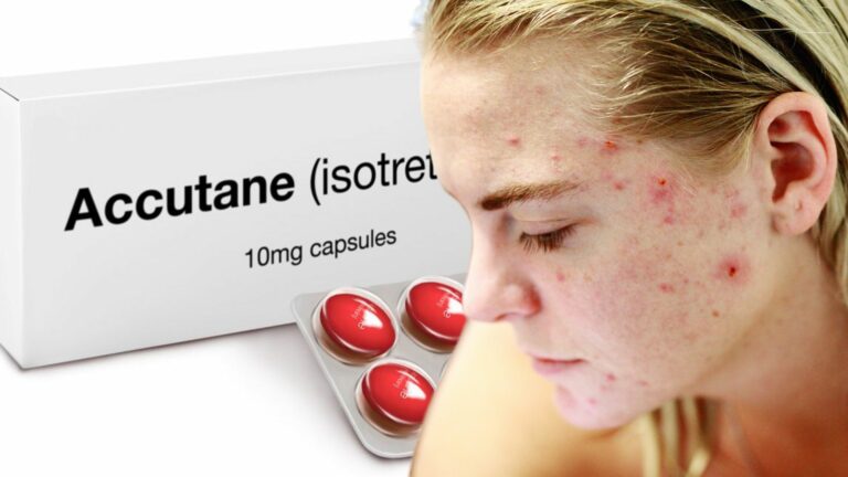 Accutane: What It Is and How It Works