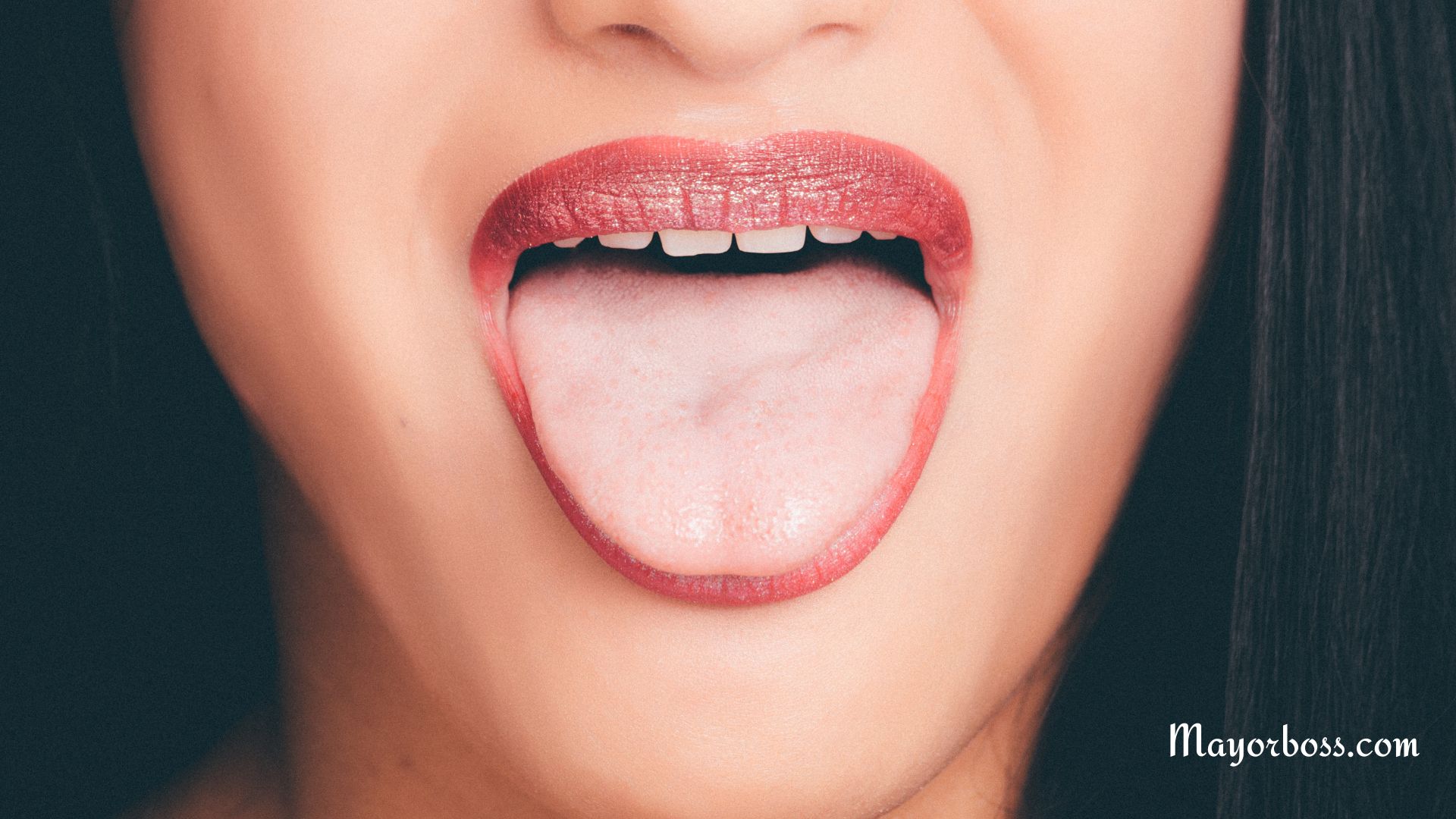 Skin Tags on Tongue