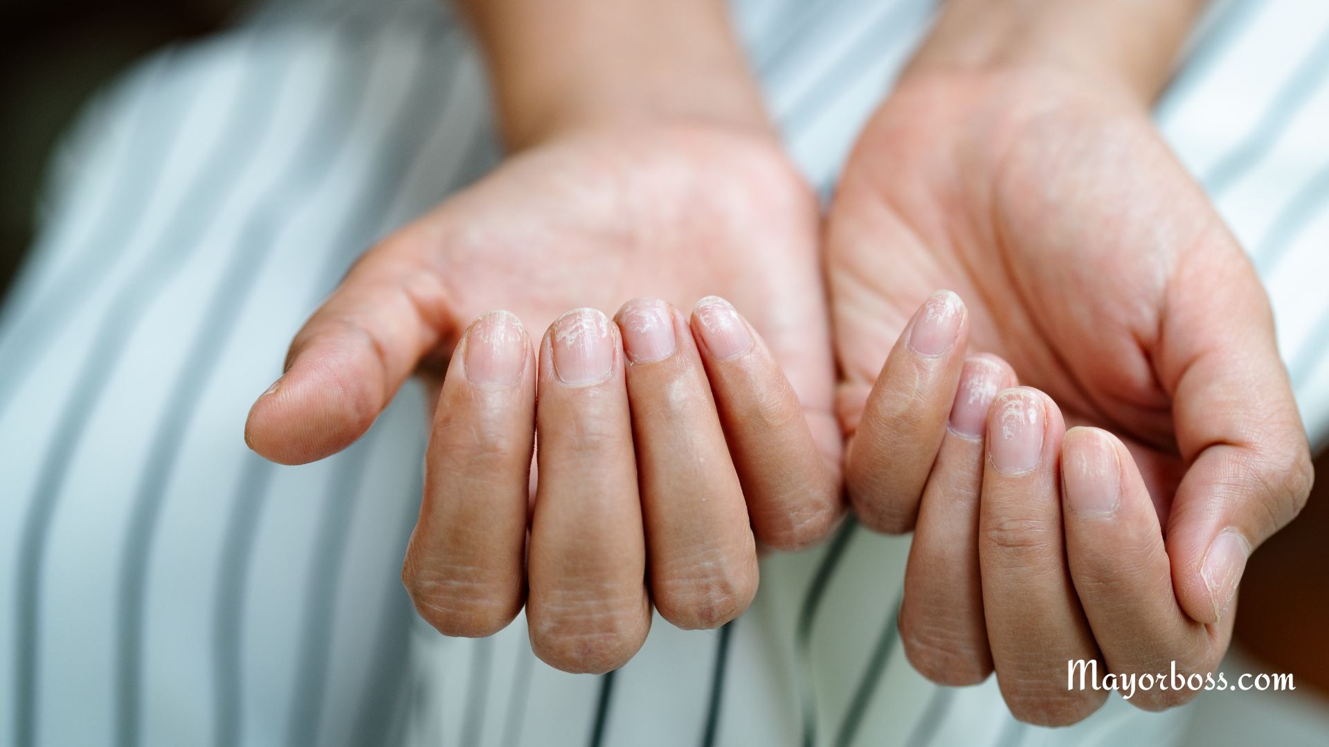 Things Your Fingernails Reveal About Your Health