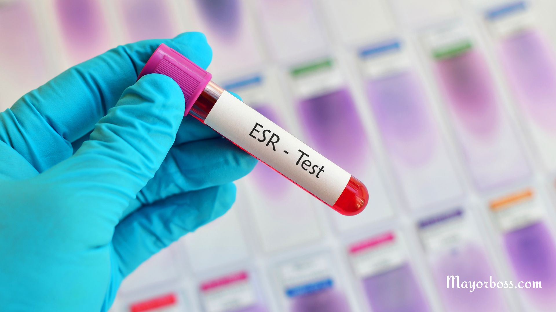 What It Means When Your ESR Blood Test is High