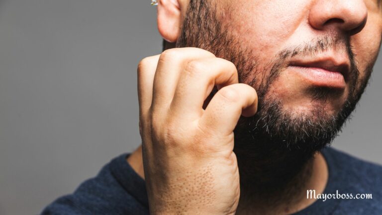 Why Does Your Beard Itch?