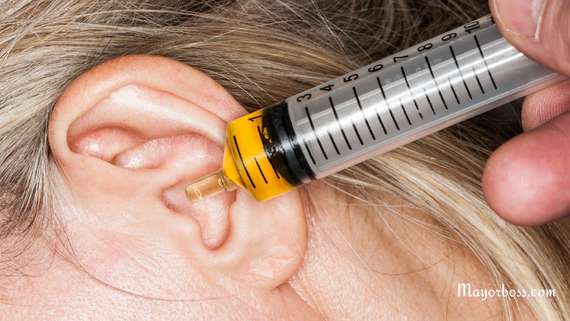 Is Castor Oil Safe for Ear Infections? Pros and Cons