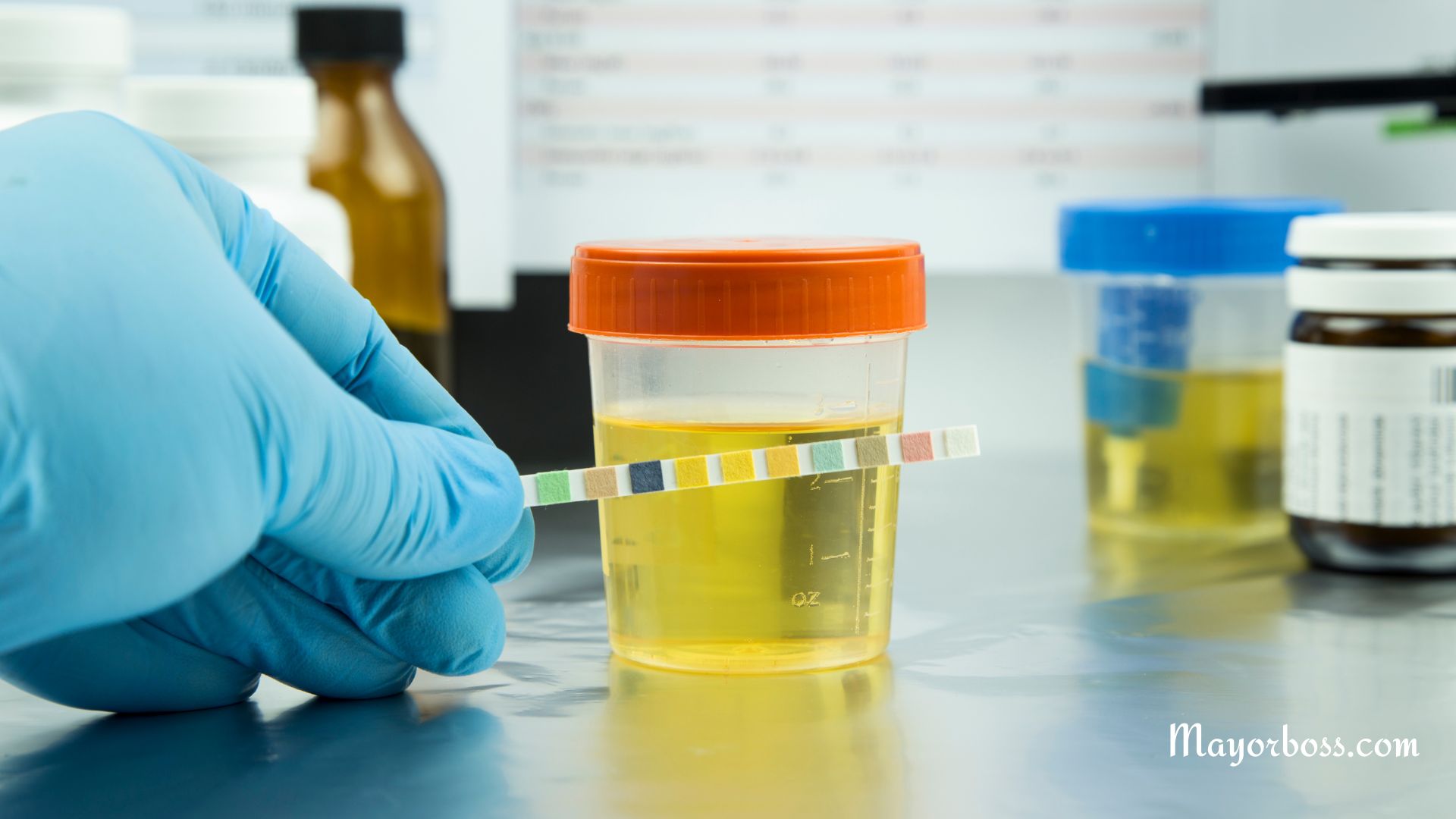 What Does Your Urine Color Say About Your Health?