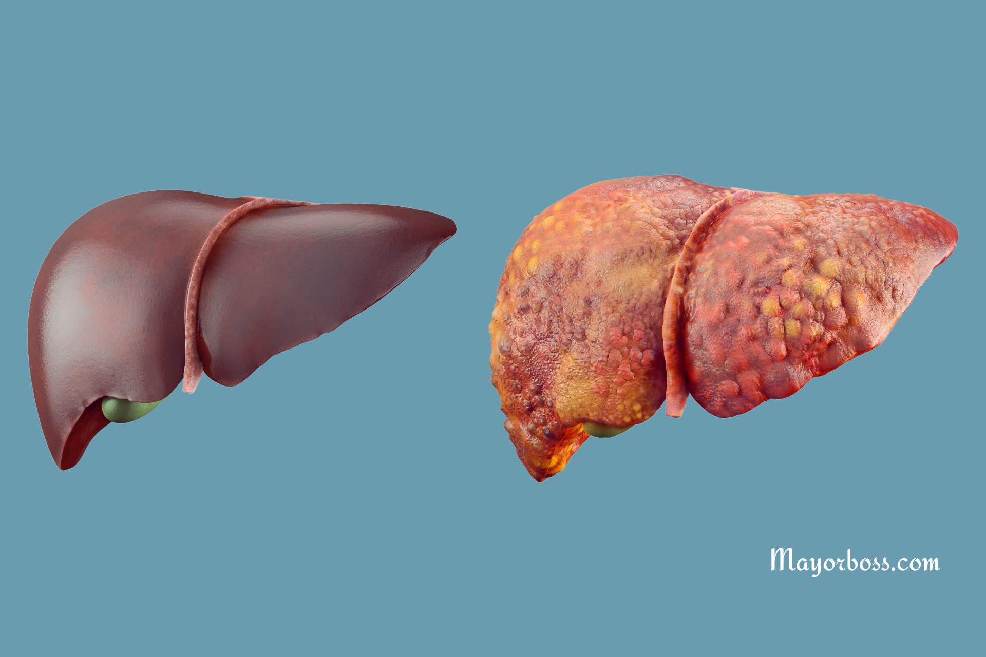 5 Drugs That Cause Liver Damage: Do Not Ignore This