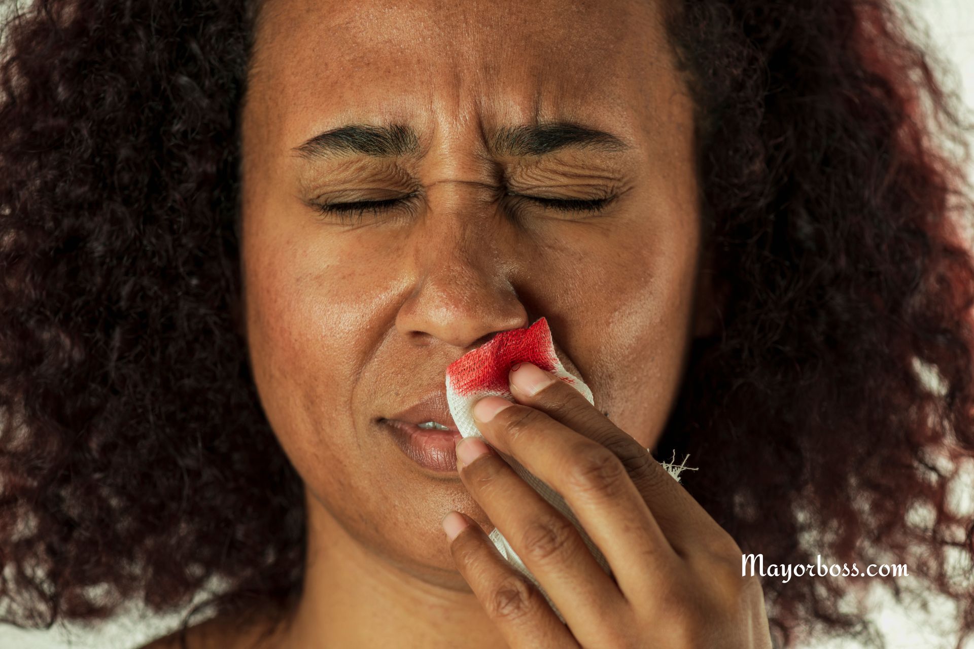 High Blood Pressure Can Make Blood Vessels in Your Nose Burst, Causing Nosebleeds