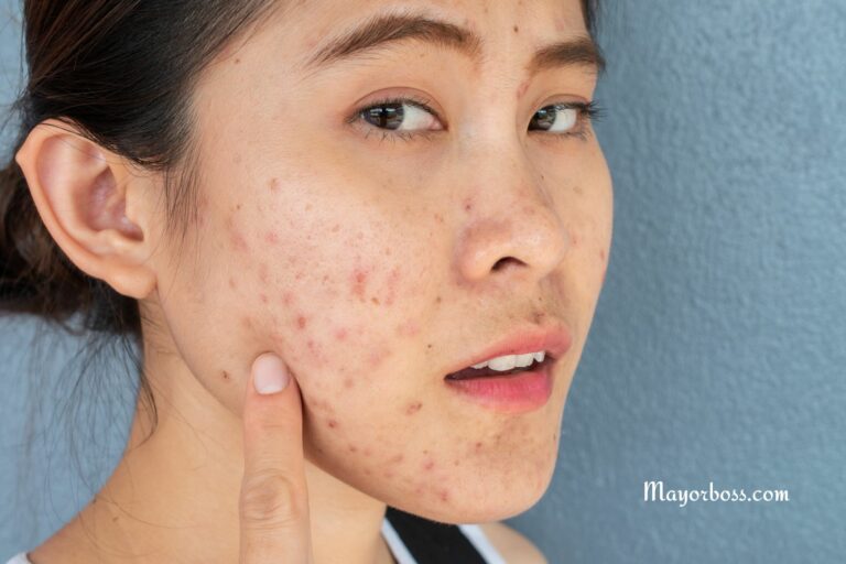 How to Remove Spots and Black Dots on Face Skin