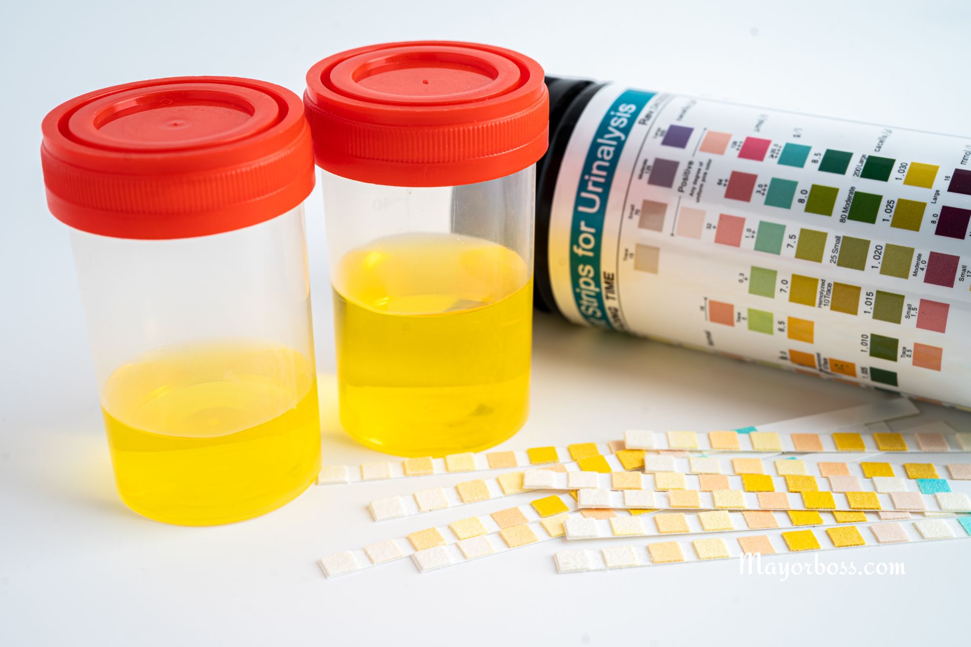 Is It Normal to Have Urine in Bright Yellow Color?