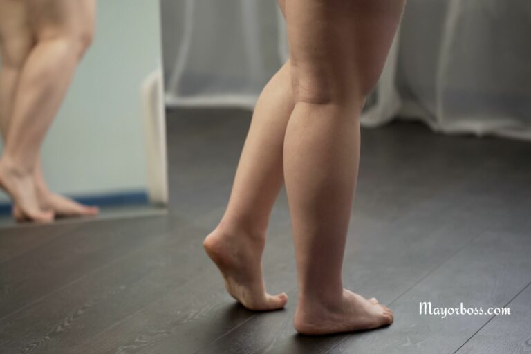 What Causes Cankles and How Can You Reduce Their Appearance?