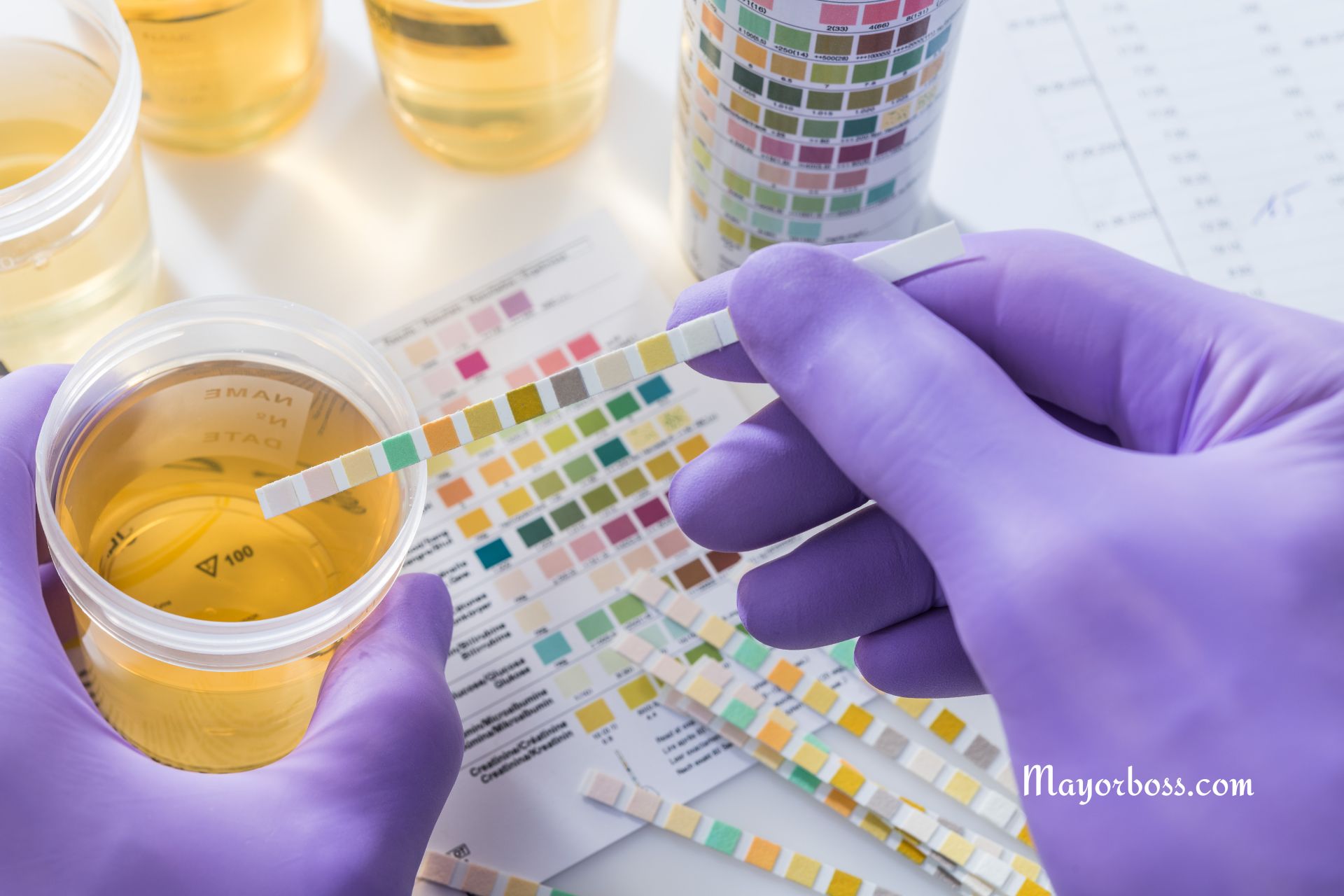 Is Your Urine pH Normal? Find Out the Ideal Range