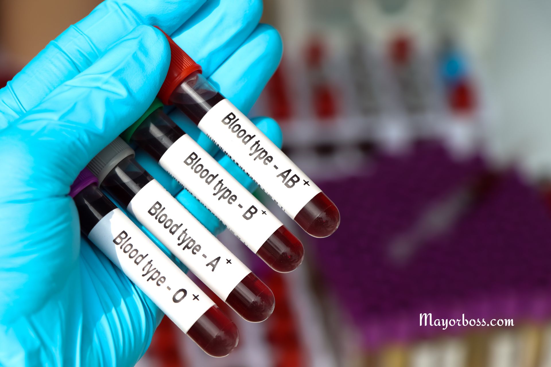 Not Sure of Your Blood Type? Here’s Why It’s Time to Find Out