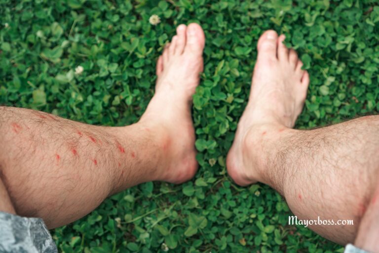 Red Spots on the Skin? Here’s What They Could Be & What To Do