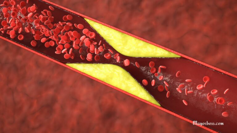 10 Blood Clot Warning Signs You Can’t Ignore