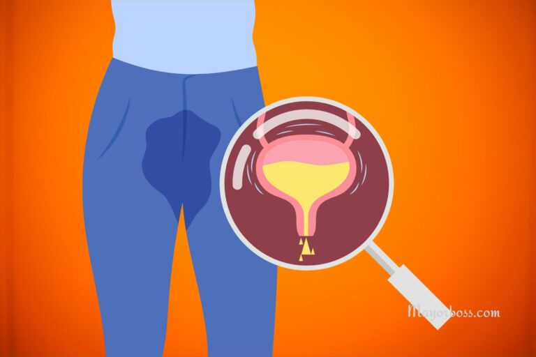 7 Things That Cause An Overactive Bladder
