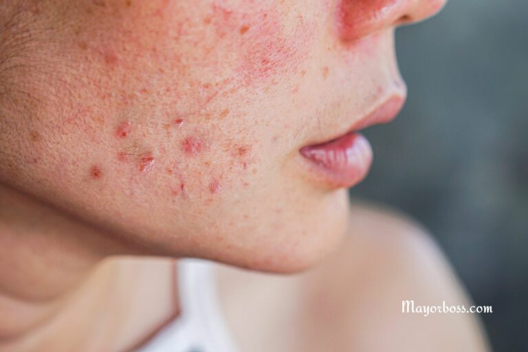 7 Warning Signs Your Body is Saying STOP Eating Sugar!