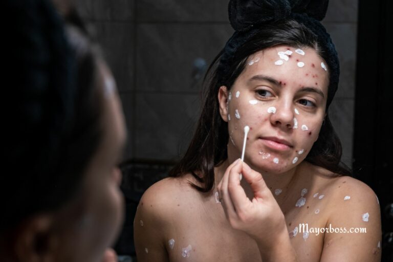 How Many Times Can You Get Chickenpox in Your Life?