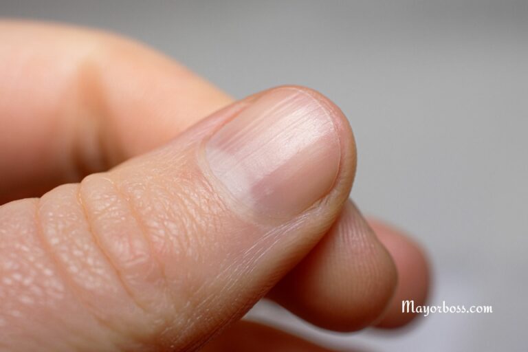 If You Have The Half Moon Shape On Your Nails, This Is What It Means