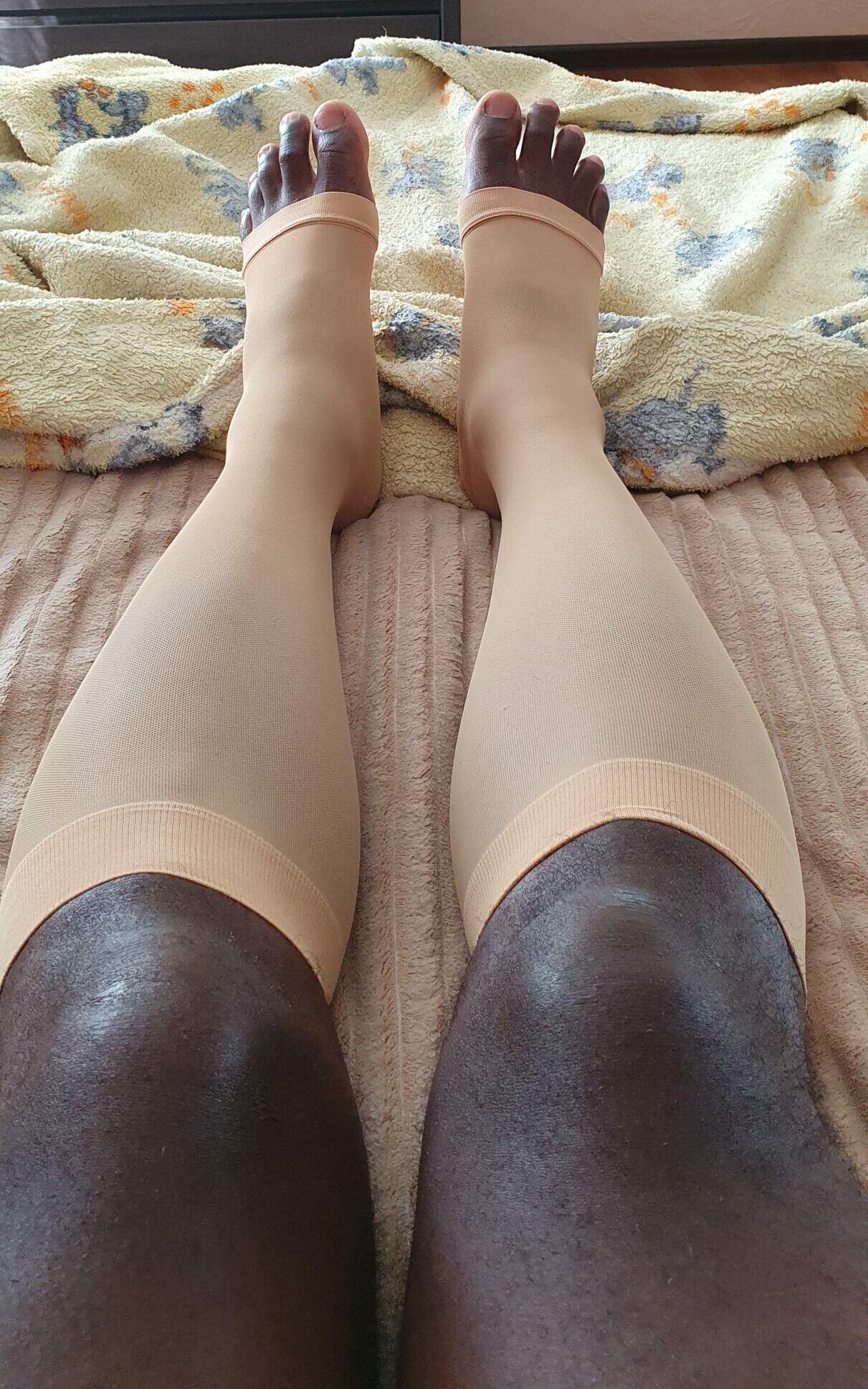 Wear Compression Socks to Bed Tonight