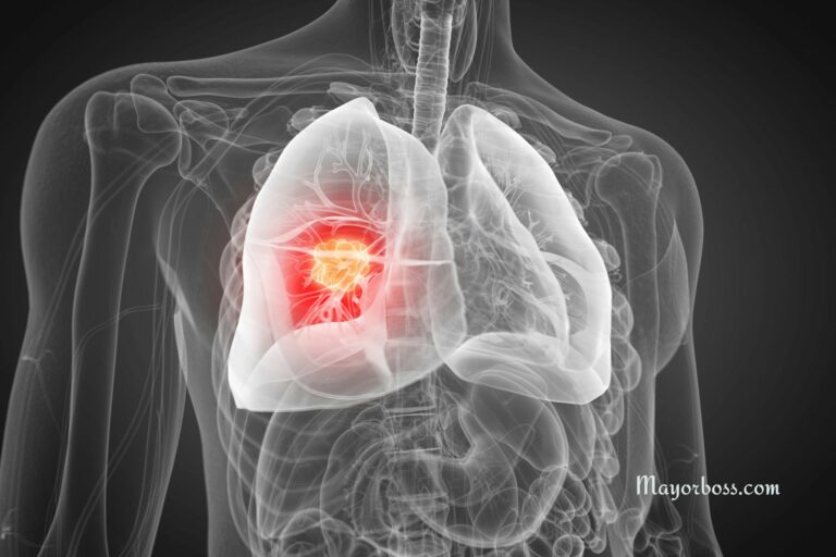 8 Signs of Lung Cancer That Can Appear Six Months Before Diagnosis