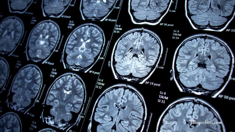 What Is the Difference Between CT and MRI?