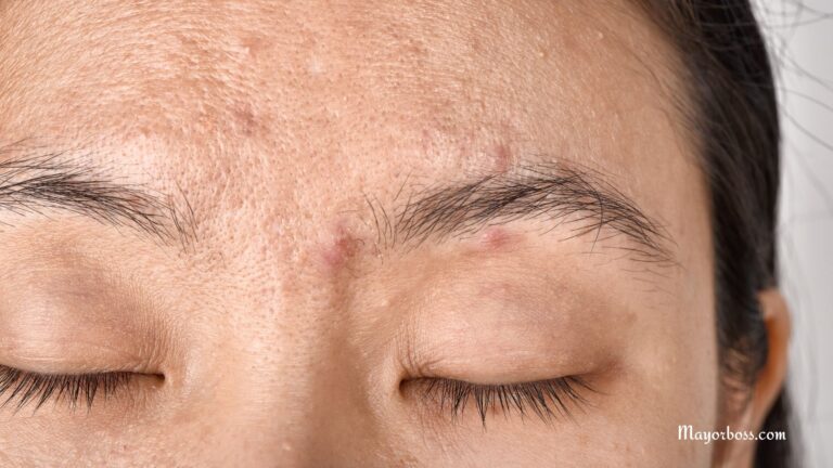 Symptoms of Dehydrated Skin