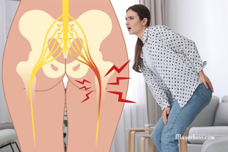 Why You Should Never Ignore Sciatic Nerve Pain