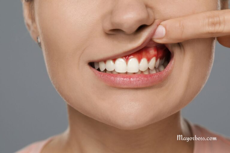 Abscess: Types, Symptoms, Causes and Treatment