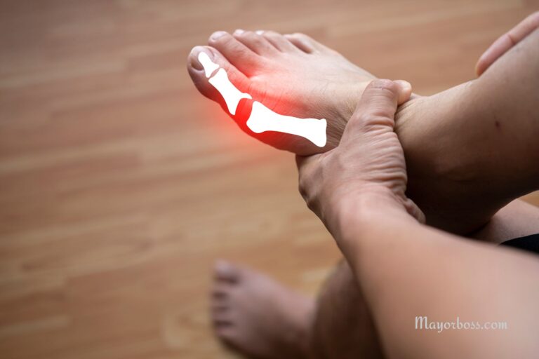 10 Warning Signs Of High Uric Acid In Women