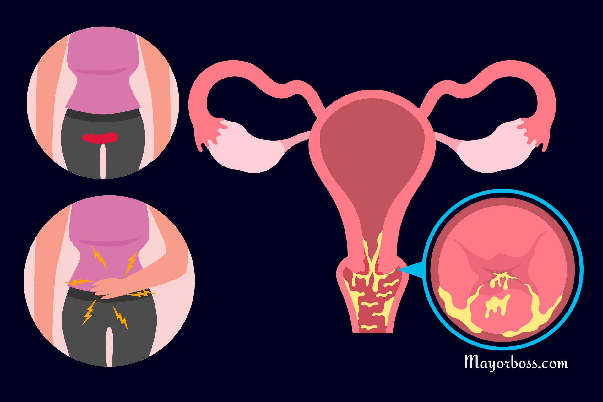 Visible Signs of Cervical Cancer