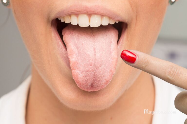 What Does Your Tongue Says About Your Health