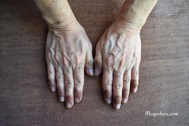 What It Means When You Have Blue Veins on Palms of Hands and Fingers