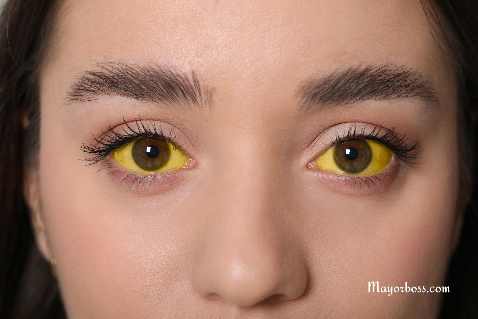 What Does It Mean When Your Eyes Turn Yellow?