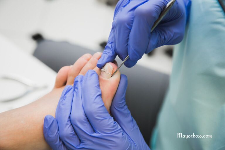 What It Means When Your Fingernail or Toenail Is Separating From the Nail Bed